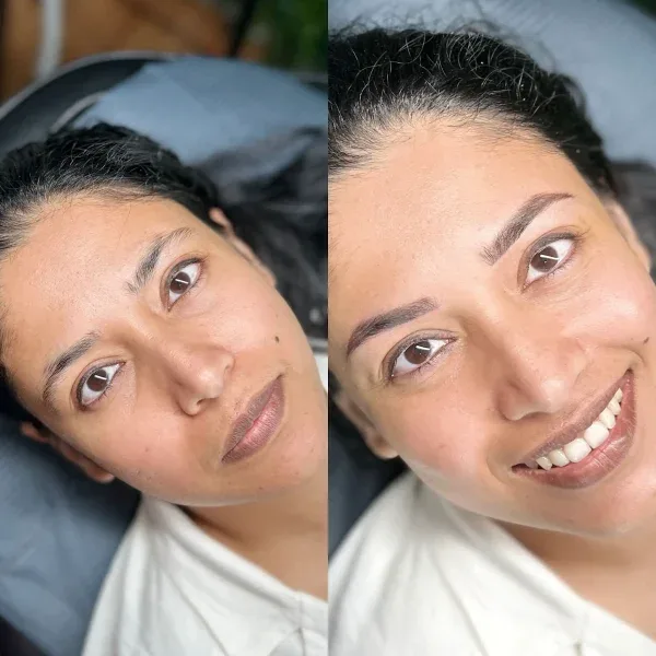 Brow before and after — full face view showing overall definition